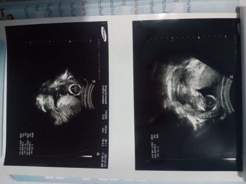แนะนำโรงบาลแถวสมุทรปราการให้ทีค่ะ