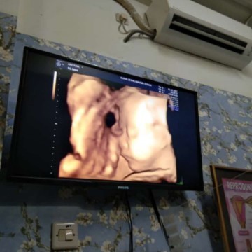 28minggu,semoga sehat lancar ya sayang