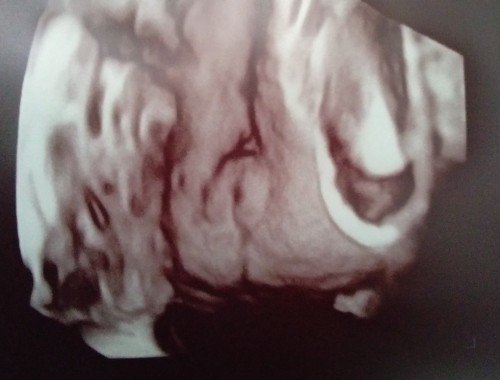 Girl or boy