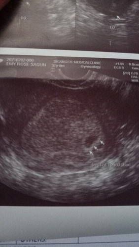 5wks ako nun 1st ultrasnd ko,after 2wks check uli, lumki lng konte gs at 5wks parin,ok lng kaya un