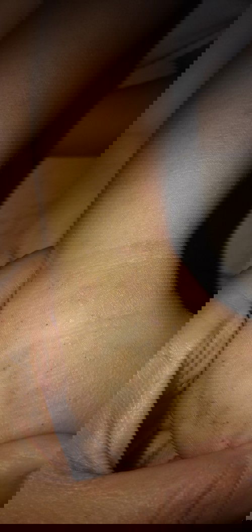 Minta solusi bun supaya gatal2nya ilang