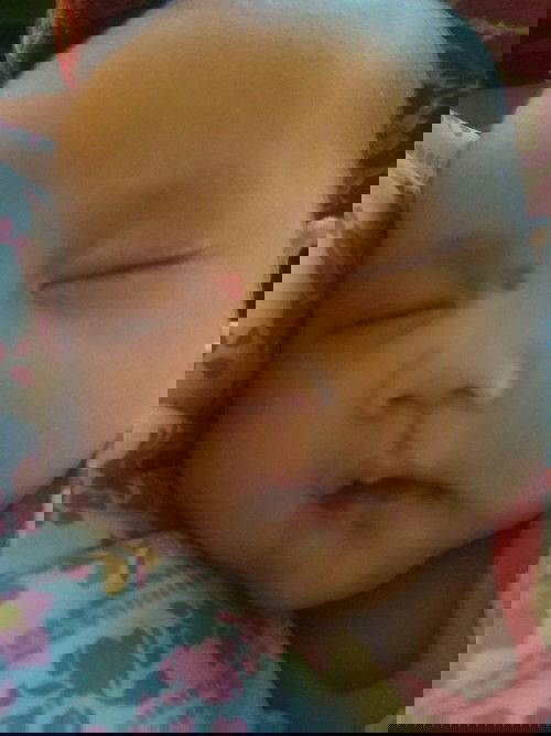 maaf saya mau bertanya, tanda lahir di hidung yang memerah dan menonjol (timbul) itu bahaya gak ya?