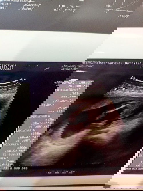 แม่ๆช่วยดูทีค่ะว่า ผช.หรือผญ.