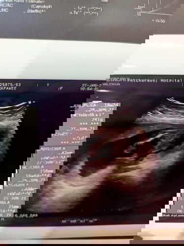 แม่ๆช่วยดูทีค่ะว่า ผช.หรือผญ.