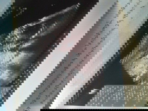 คุณแม่พอจะดูออกกันไหมค่ะว่าน้องเพศอะไร😍