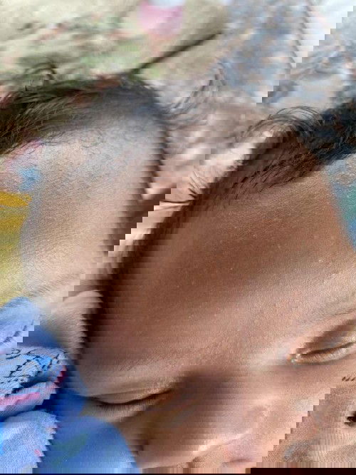 Bruntusan di wajah bayi 1 bulan