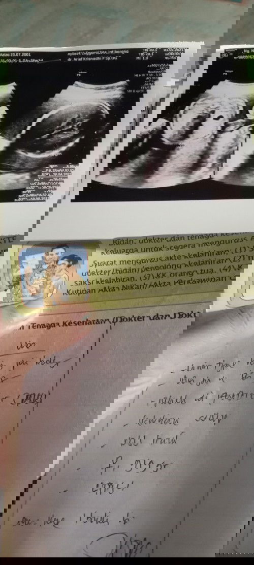 Bun LG galau nih 🥺