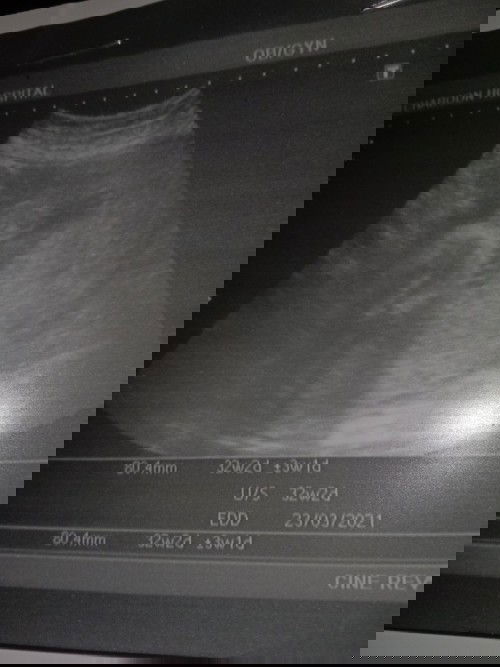 แม่ๆทั้งหลายช่วยดูหน่อยคะว่าหญิงรึชายคะ