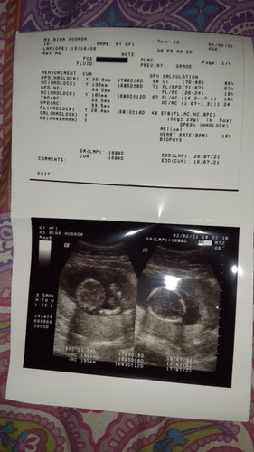 bund mau tanya dong, aku hamil sudah 16 minggu berat babynya 152gr, itu terlalu besar atau engga ya?