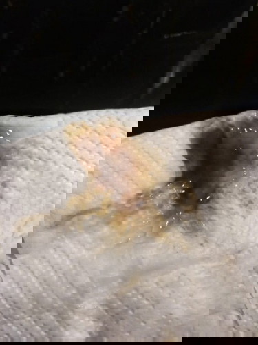 Mucus plug?