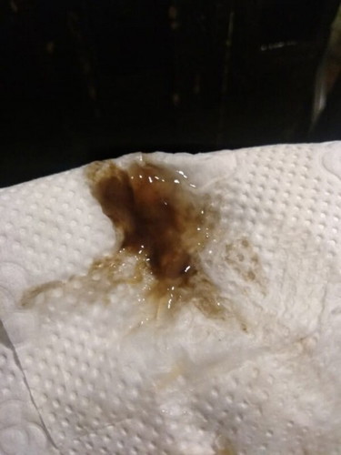 Mucus plug?