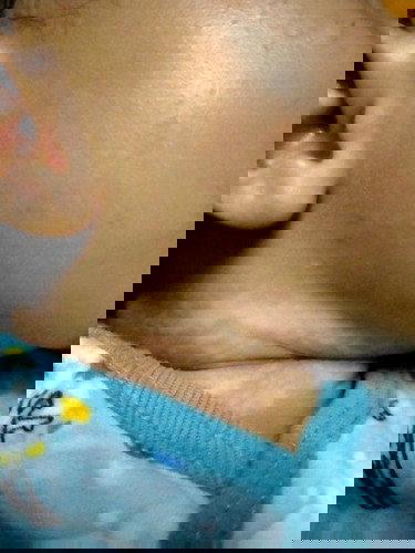 Kulit leher bayi belang