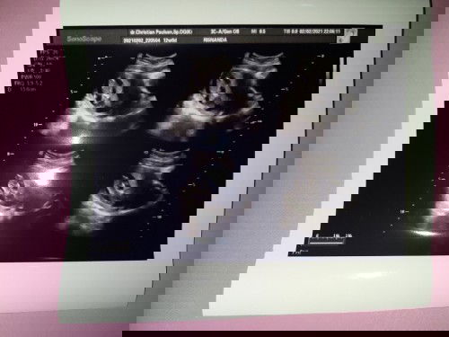 Bidan Yogyakarta dan sekitarnya