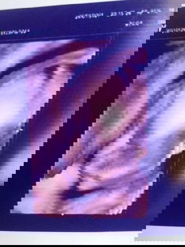 Như này có phải mũi cao không các mẹ♥️