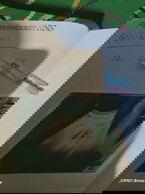 Usia kandungan 5week2day