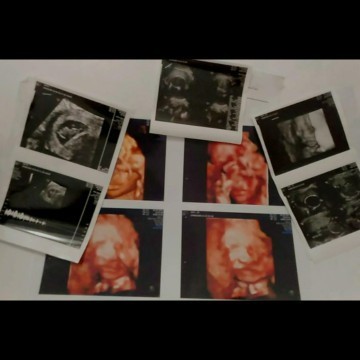 Sungsang 7 bulan