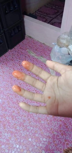 ขอความแนะนำจากแม่ๆคะ