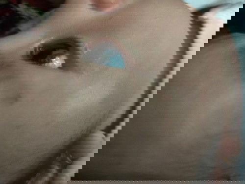 bercak putih di wajah bayi seperti panu