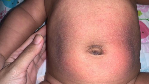 Ada tak sesiapa yg baby die kene mcm ni juga?