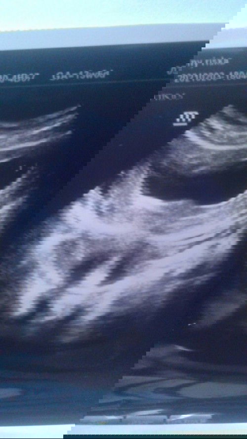 kecewa campur aduk sedih😭