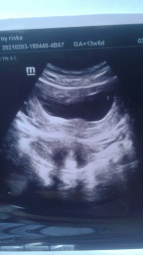 kecewa campur aduk sedihđ