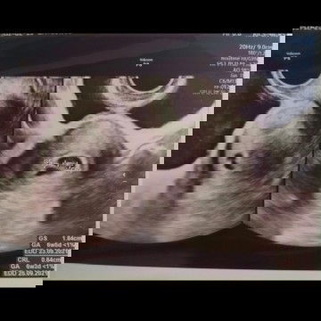 Ukuran janin dan detak jantung