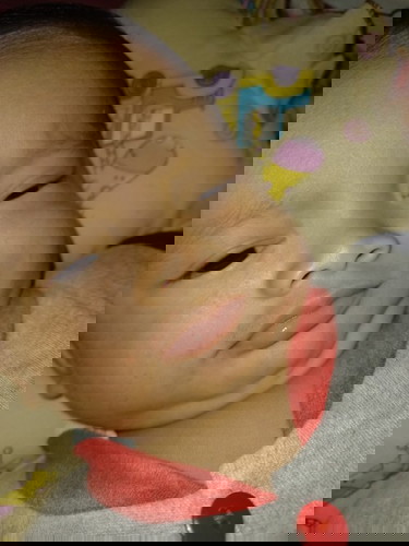 Pipi bintik"