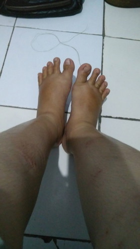bunda mau nanya apakah kalau hamil besar wajib cek lab ?
kaki saya pada bengkak , kira2 wajar tidak?