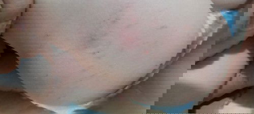 Bantu solusi  ya bunda🙏