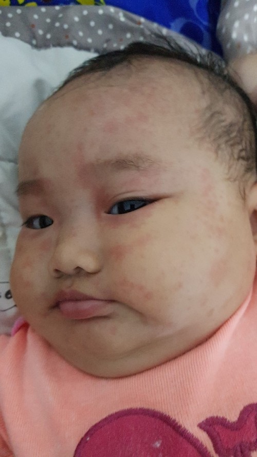 Bintik2 merah