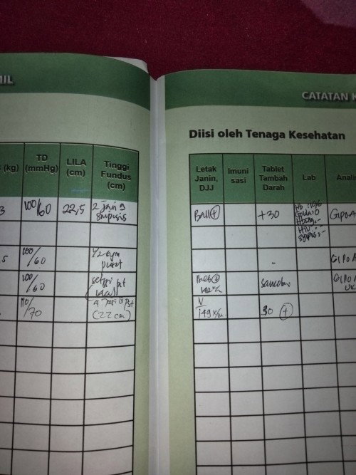 Tinggi fudus