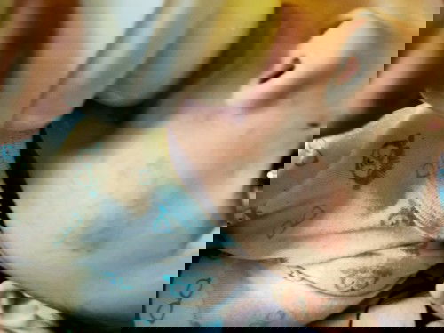 Dry Skin sa Face ni Baby