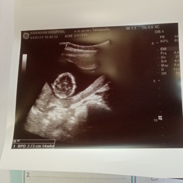 14+6ค่ะท้องแรก