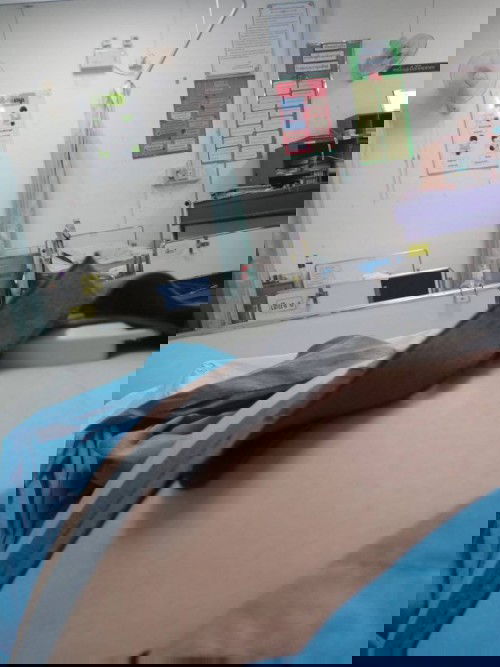 ท้องแข็งบ่อยหมอให้มานอนดูอาการ35+6