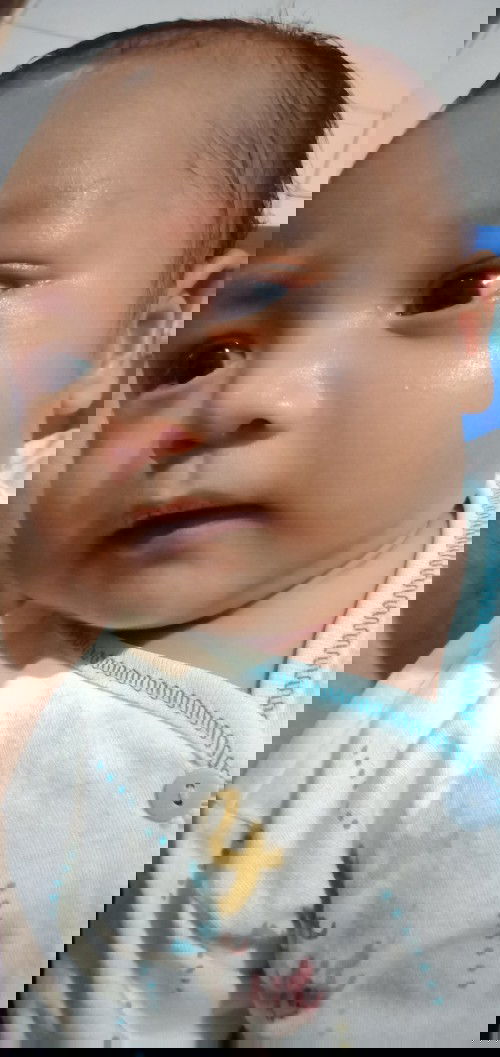 Diare pd bayi 2 bulan..