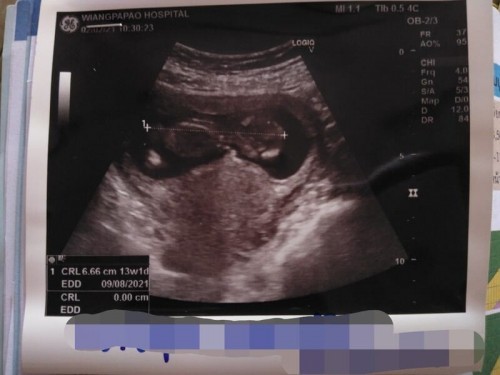 ภาพซาวด์ตอน 13+1 ค่ะ มีคนเดียวแต่เหมือนแฝด