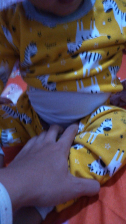 Perut bayi buncit