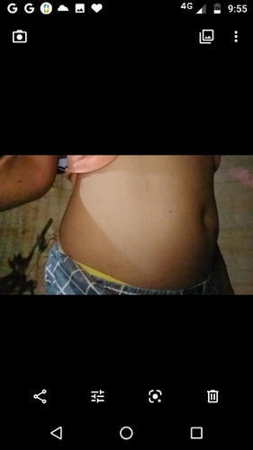 Baby bump?