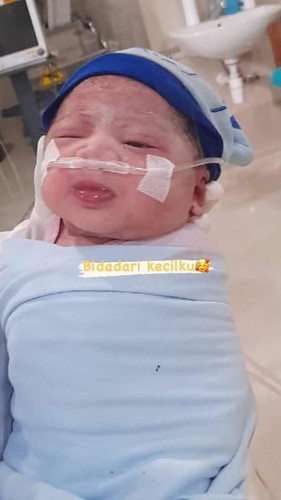 Baby girl (syaqilla nasya shanum)