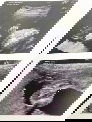 หญิงหรือชายน๊าา?