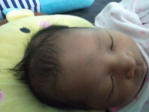 แม่ๆท่านไหนคลอดเองแล้วหัวน้องบวมมั้ยคะ