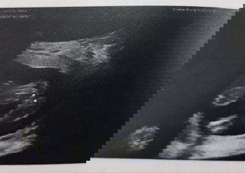 แม่ ๆ ว่า ผช รึ ผญ