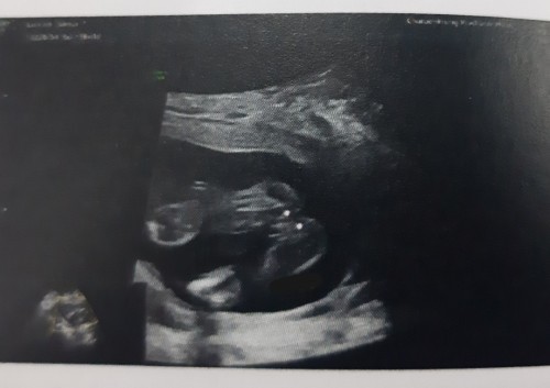 แม่ ๆ ว่า ผช รึ ผญ