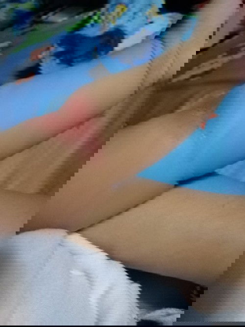 Home Remedies for elbow crease rashes