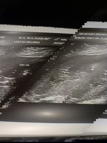 GENDER REVEAL! 👶🏻 I'm on 19 weeks and 5 days po 💕
