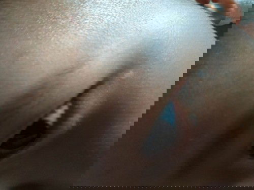 Kulit putih sekitar mata