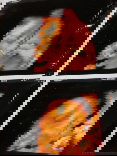 ทีมมีนาคม♥️