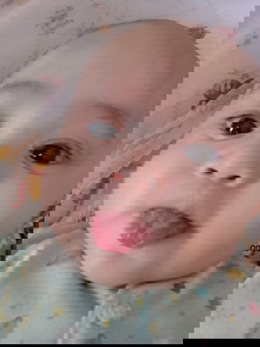Bun mau nanya lidah anak kek gitu kenapa ya Bun
Sering betul anak saya melet2 kluar lidah gitu