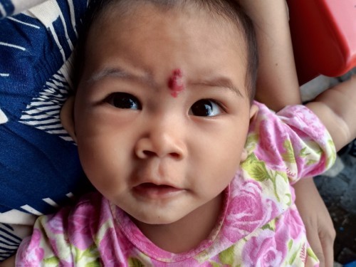 Tanda lahir merah
