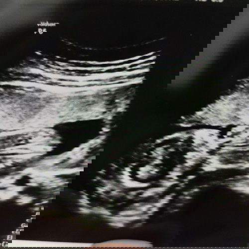 Teka Jantina.. is it a boy or girl?